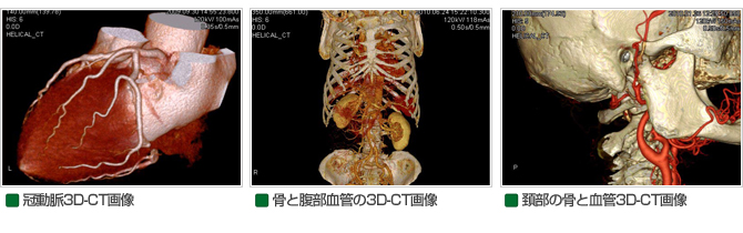 3D-CT画像