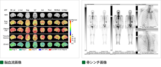 脳血流、骨シンチの様子