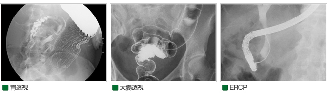 胃・大腸透視、ERCP