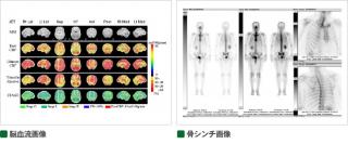 わかりやすい核医学（裁断済み） 裁断済】わかりやすい核医学 第2版 裁断済】わかりやすい核医学