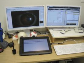 電子カルテの導入 電子カルテの導入