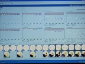 わかりやすい視野経過表 わかりやすい視野経過表